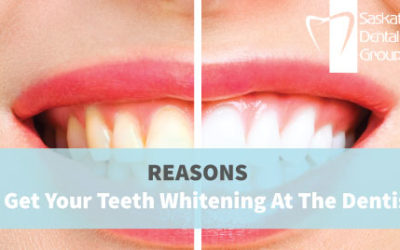 Reasons To Get Your Teeth Whitening Done At Your Dentist’s Office