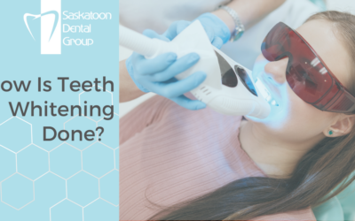 How Is Teeth Whitening Done?