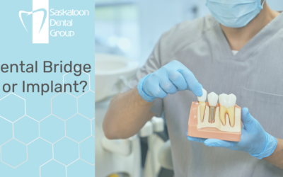 Dental Bridge or Implant?