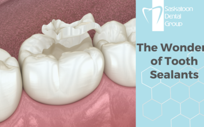 The Wonders of Tooth Sealants