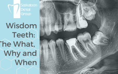 Wisdom Teeth: The What, Why, and When